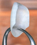 porselen lamine 02